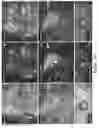Fig. 06 - Method of detecting diseased or damaged tissue with a pH-triggered polypeptide fluorophore composition