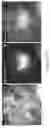 Fig. 08 - Method of detecting diseased or damaged tissue with a pH-triggered polypeptide fluorophore composition