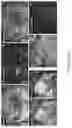 Fig. 09 - Method of detecting diseased or damaged tissue with a pH-triggered polypeptide fluorophore composition