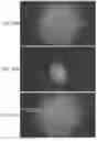 Fig. 37 - Method of detecting diseased or damaged tissue with a pH-triggered polypeptide fluorophore composition