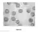 Fig. 16 - Radiopaque monomers, polymers, microspheres, and methods related thereto
