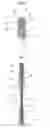 Fig. 03 - Living cell transplanting tool