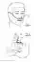 Fig. 02 - Methods, systems and devices for non-invasive ventilation including a non-sealing ventilation interface with an entrainment port and/or pressure feature