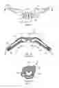 Fig. 07 - Methods, systems and devices for non-invasive ventilation including a non-sealing ventilation interface with an entrainment port and/or pressure feature