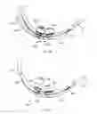 Fig. 14 - Methods, systems and devices for non-invasive ventilation including a non-sealing ventilation interface with an entrainment port and/or pressure feature