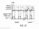 Fig. 24 - Methods, systems and devices for non-invasive ventilation including a non-sealing ventilation interface with an entrainment port and/or pressure feature