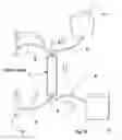 Fig. 09 - Method for preparing tissue, particularly adipose tissue, for transplantation from lobular fat extracted by liposuction