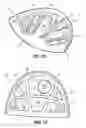 Fig. 09 - Mixed material golf club head