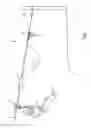 Fig. 02 - Emergency arrest device for zip line