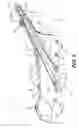 Fig. 06 - Snowmobile fuel tank