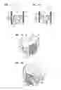 Fig. 08 - CHILD RESISTANT ZIPPER CLOSURE FOR RECLOSEABLE POUCH WITH DOUBLE SLIDER AND METHODS