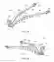 Fig. 02 - Lifting system including rotating attachment link