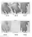 Fig. 09 - Protein proximity assay in formalin fixed paraffin embedded tissue using caged haptens