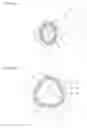 Fig. 07 - Wave generator and strain wave gearing