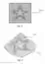 Fig. 04 - Controlled caustic generator surface lighting device forming a pattern on a target surface