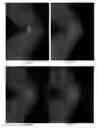 Fig. 12 - METHOD FOR DETECTING ANALYTES USING DIELECTROPHORESIS RELATED APPLICATIONS