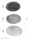 Fig. 02 - Methods for measuring oxidative stress in human body fluids