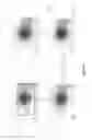 Fig. 03 - Image processing method and system for iris recognition