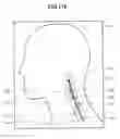 Fig. 35 - Medical image processing apparatus, medical image processing method, medium, and medical image processing system