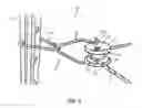 Fig. 02 - Insulator attachment