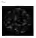 Fig. 02 - Soft magnetic alloy and magnetic device