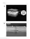 Fig. 06 - Perovskite light emitting device containing exciton buffer layer and method for manufacturing same