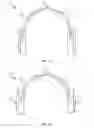 Fig. 02 - Automatic left/right earpiece determination