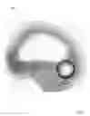 Fig. 04 - Acoustic Earpiece System