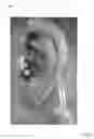 Fig. 06 - Acoustic Earpiece System