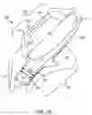 Fig. 04 - Earpiece positioning and retaining