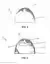 Fig. 08 - Potted plant support apparatus