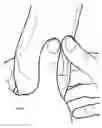 Fig. 07 - Tools and methods for fitting orthoses