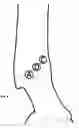 Fig. 09 - Tools and methods for fitting orthoses