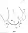 Fig. 06 - Removable underwire for brassieres