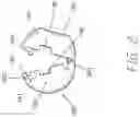 Fig. 03 - DEVICE FOR PREVENTING RETRACTION OF CORDS AND DRAWSTRINGS