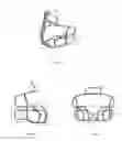 Fig. 06 - ATHLETIC HELMET-FACEMASKS SYSTEM