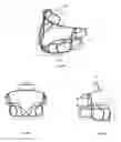 Fig. 07 - ATHLETIC HELMET-FACEMASKS SYSTEM