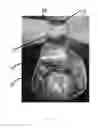 Fig. 09 - Bag with Removable Pouch