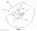 Fig. 05 - Infant Supporting Pillow