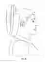 Fig. 06 - Neck Support