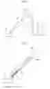 Fig. 02 - Suction tool and electric vacuum cleaner