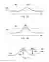 Fig. 07 - Systems and methods for instrument buckling detection