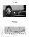 Fig. 07 - Multi-wavelength endoscopic system and image processing method using same