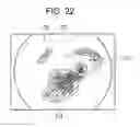 Fig. 22 - Endoscope system