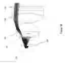 Fig. 22 - Wide-field retinal imaging system