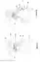 Fig. 33 - Wide-field retinal imaging system