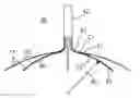 Fig. 01 - Catheter with staggered electrodes spine assembly