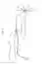 Fig. 02 - Catheter with increased electrode density spine assembly having reinforced spine covers