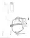 Fig. 02 - Head tracking frame for dental navigation