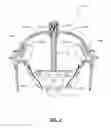 Fig. 03 - Head tracking frame for dental navigation